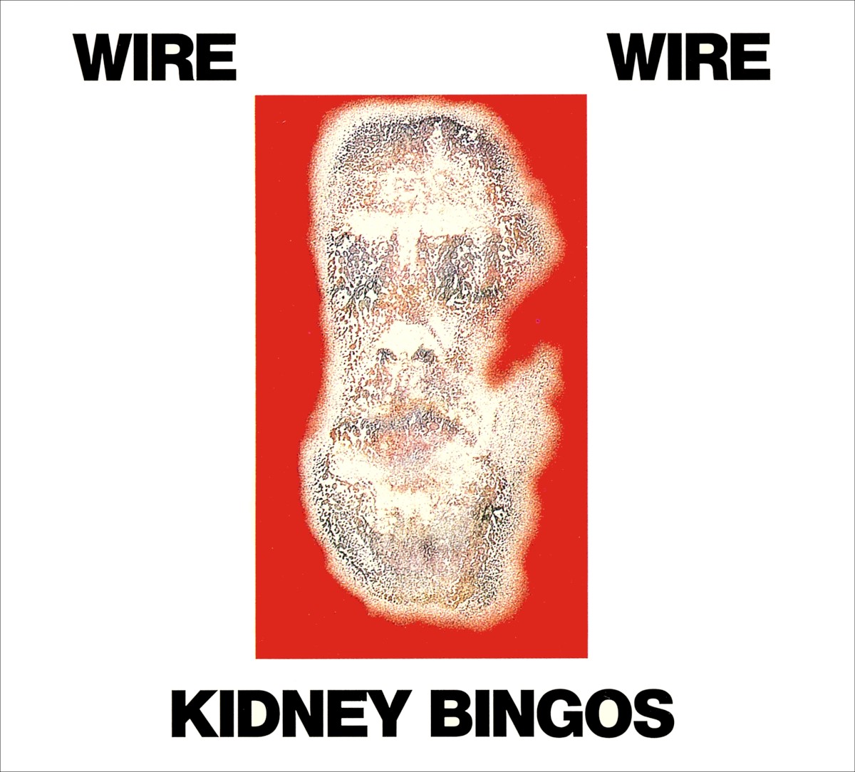 Kidney Bingos cover