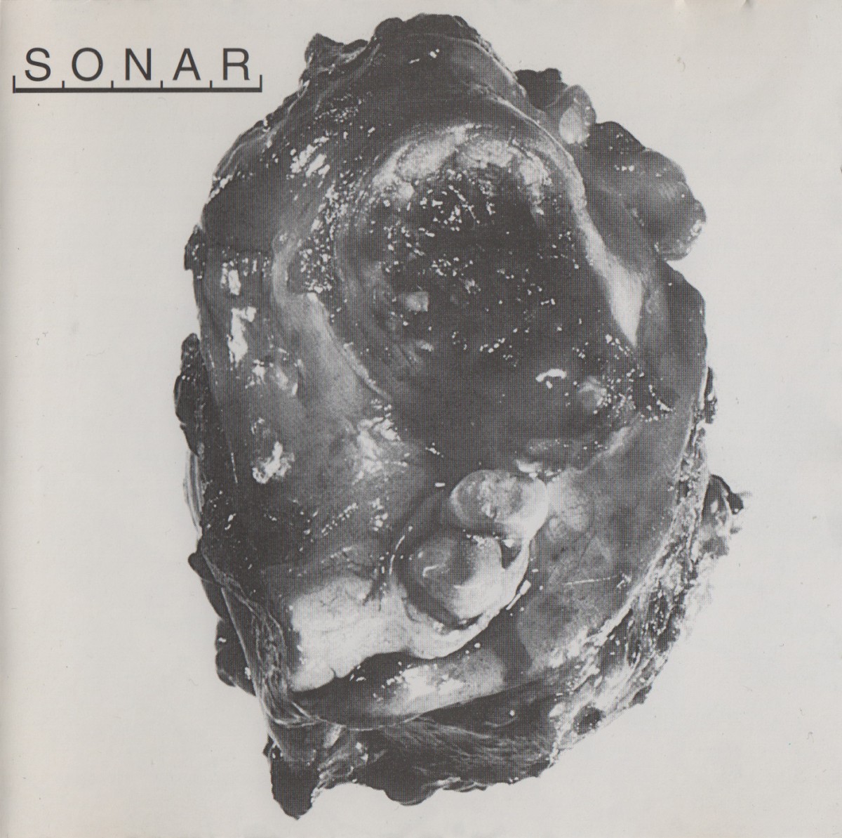 Sonar cover